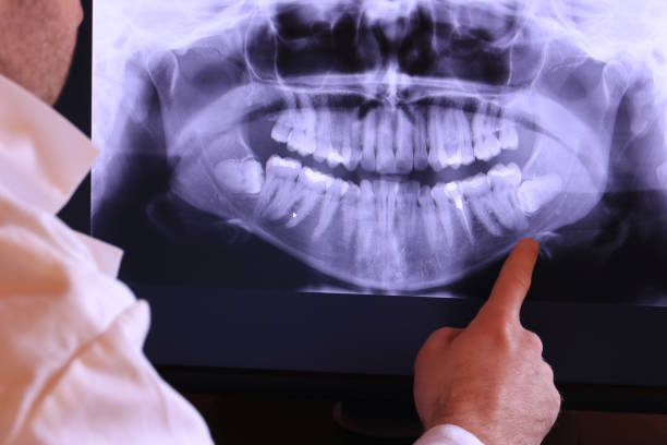 Best Emergency Gum Treatment in Grand Mound, WA